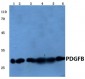 PDGF-BB Antibody (aa21-70)